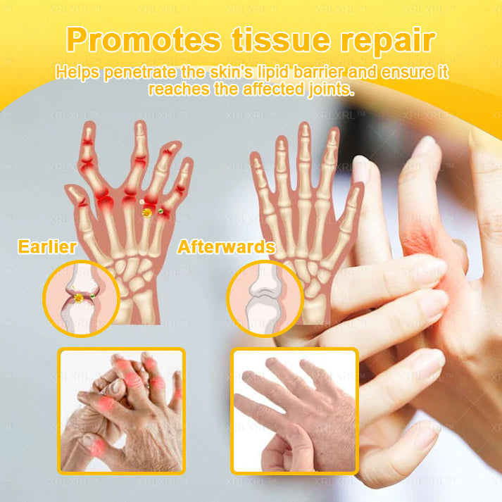 XRLXRL® Bee Venom Pain-Relief Bone Healing Cream (Specially for older adults)🐇