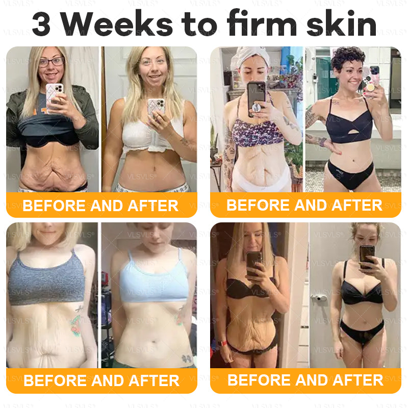 Made and Shipped from USA  ⭐✨  𝑽𝑳𝑺𝑽𝑳𝑺® Bee Venom Comprehensive Cream  LAST DAY 80% OFF(Sagging Skin, Fine Lines, Loss of Firmness, Flat Bust, Drooping Hips, and More)