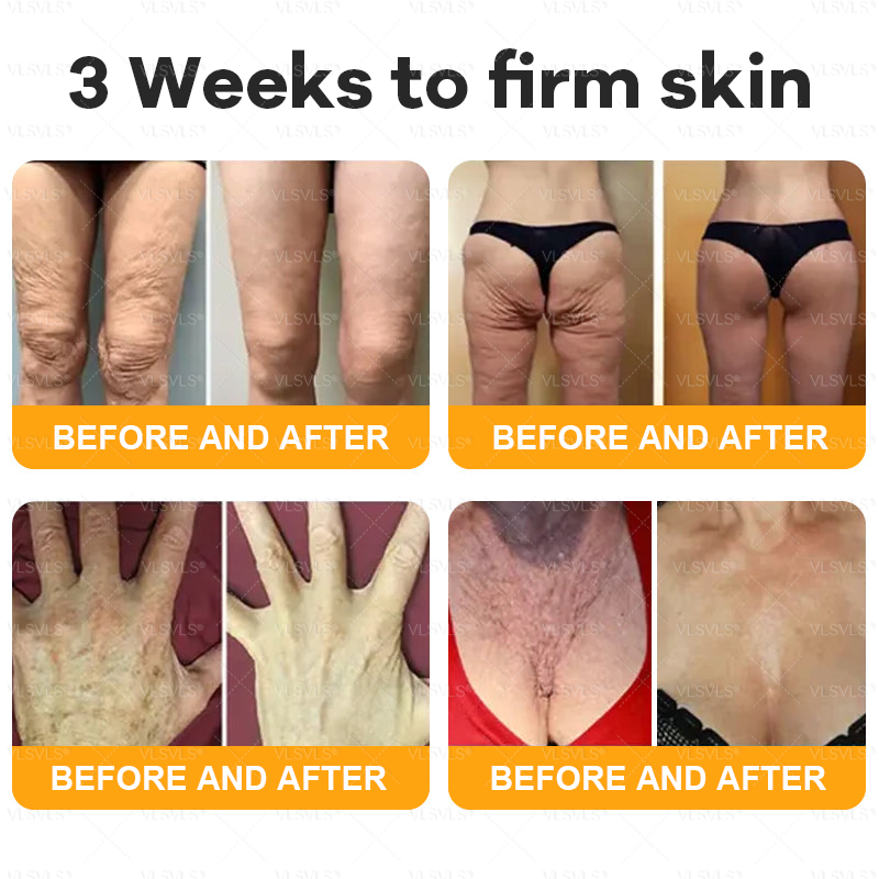 Made and Shipped from USA  ⭐✨  𝑽𝑳𝑺𝑽𝑳𝑺® Bee Venom Comprehensive Cream  LAST DAY 80% OFF(Sagging Skin, Fine Lines, Loss of Firmness, Flat Bust, Drooping Hips, and More)