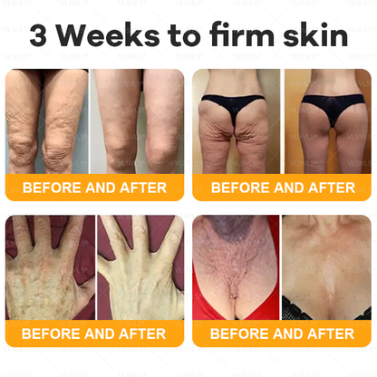 Made and Shipped from USA  ⭐✨  𝑽𝑳𝑺𝑽𝑳𝑺® Bee Venom Comprehensive Cream  LAST DAY 80% OFF(Sagging Skin, Fine Lines, Loss of Firmness, Flat Bust, Drooping Hips, and More)