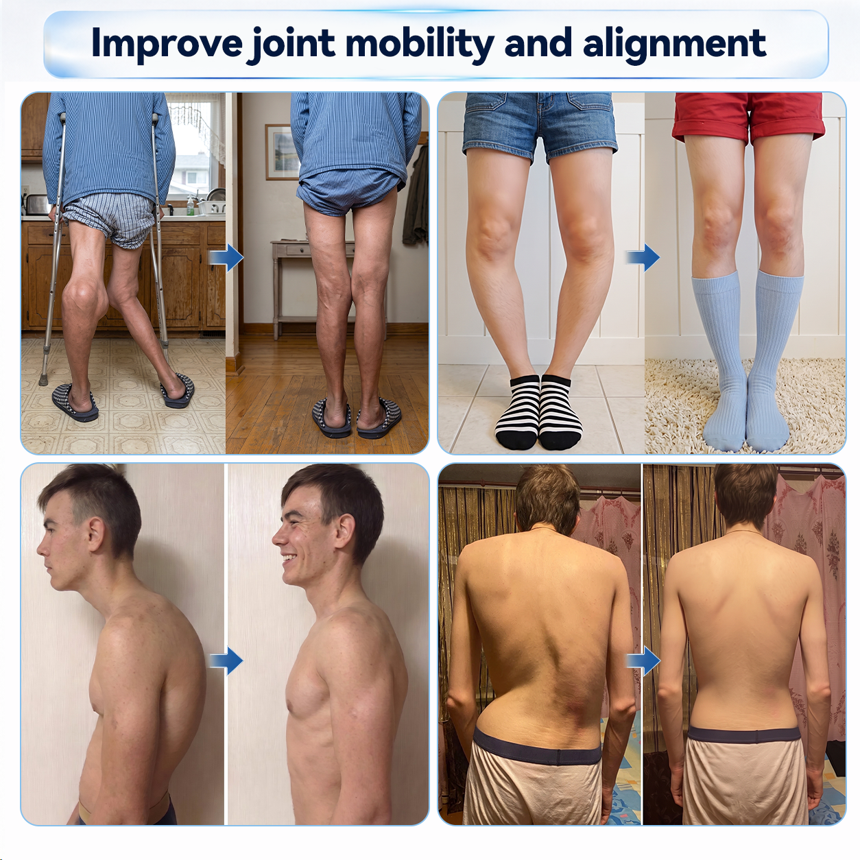 𝐏𝐡𝐲𝐬𝐢𝐜𝐢𝐚𝐧-𝐅𝐨𝐫𝐦𝐮𝐥𝐚𝐭𝐞𝐝💫| 𝑿𝑹𝑳𝑿𝑹𝑳® 0.05mm Microneedle Bone & Joint Recovery Roller