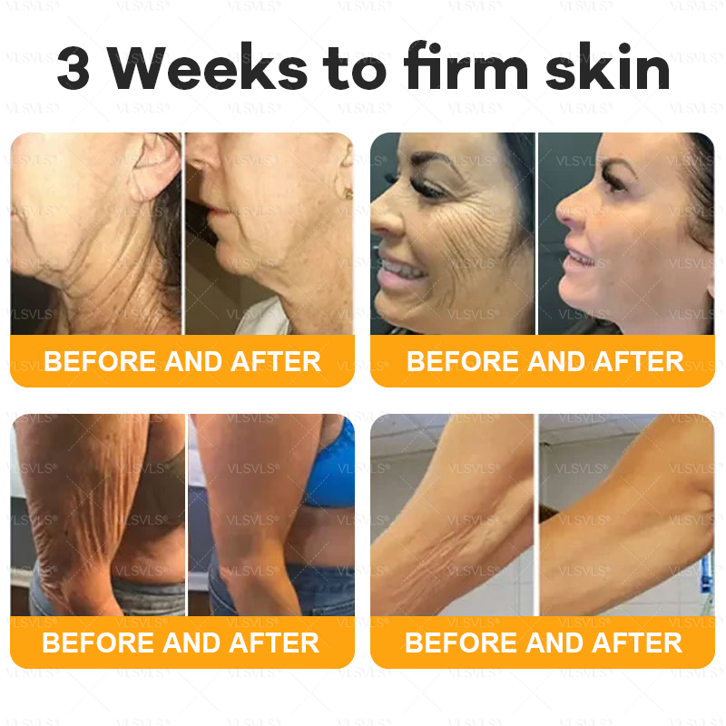 Made and Shipped from USA  ⭐✨  𝑽𝑳𝑺𝑽𝑳𝑺® Bee Venom Comprehensive Cream  LAST DAY 80% OFF(Sagging Skin, Fine Lines, Loss of Firmness, Flat Bust, Drooping Hips, and More)