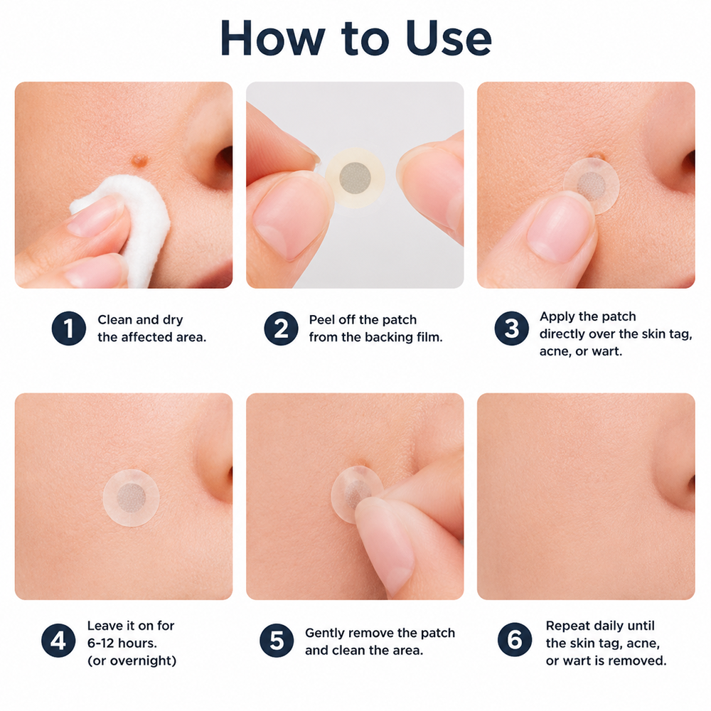 ✨Hiskin ® 2-in-1 Microneedle & Hydrocolloid Patch✨✨ | Removes raised moles, acne, flat warts, and skin tags | Helps improve wrinkles, scars, and blemishes | Invisible patches for face and body
