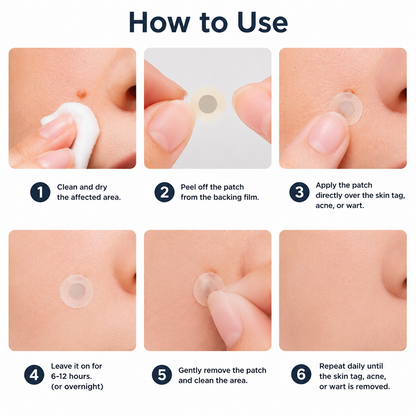 ✨Hiskin ® 2-in-1 Microneedle & Hydrocolloid Patch✨✨ | Removes raised moles, acne, flat warts, and skin tags | Helps improve wrinkles, scars, and blemishes | Invisible patches for face and body