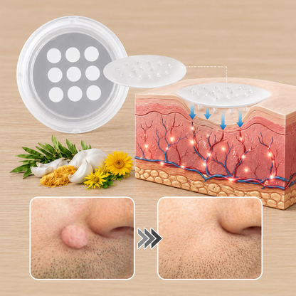 ✨Hiskin ® 2-in-1 Microneedle & Hydrocolloid Patch✨✨ | Removes raised moles, acne, flat warts, and skin tags | Helps improve wrinkles, scars, and blemishes | Invisible patches for face and body