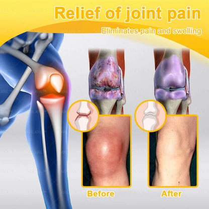XRLXRL® Bee Venom Pain-Relief Bone Healing Cream (Specially for older adults)🐇