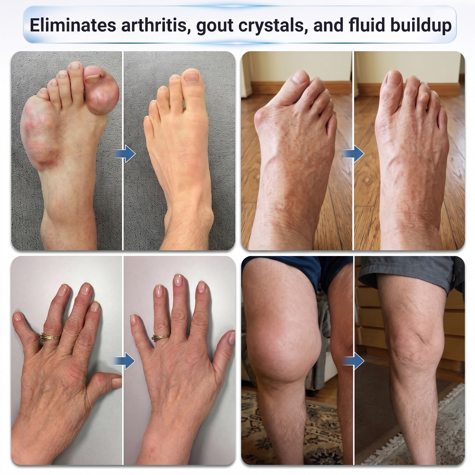 Joint and foot before-and-after comparison graphic