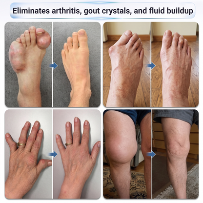 Joint and foot before-and-after comparison graphic